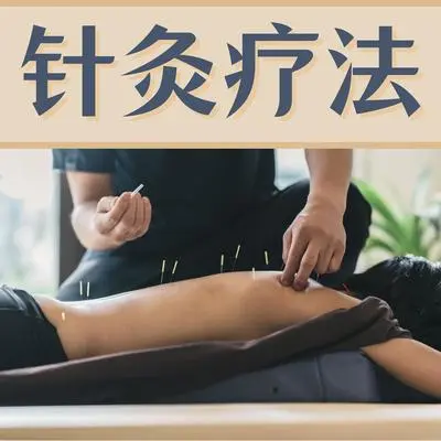 针灸疗法 - 医生止痛封面